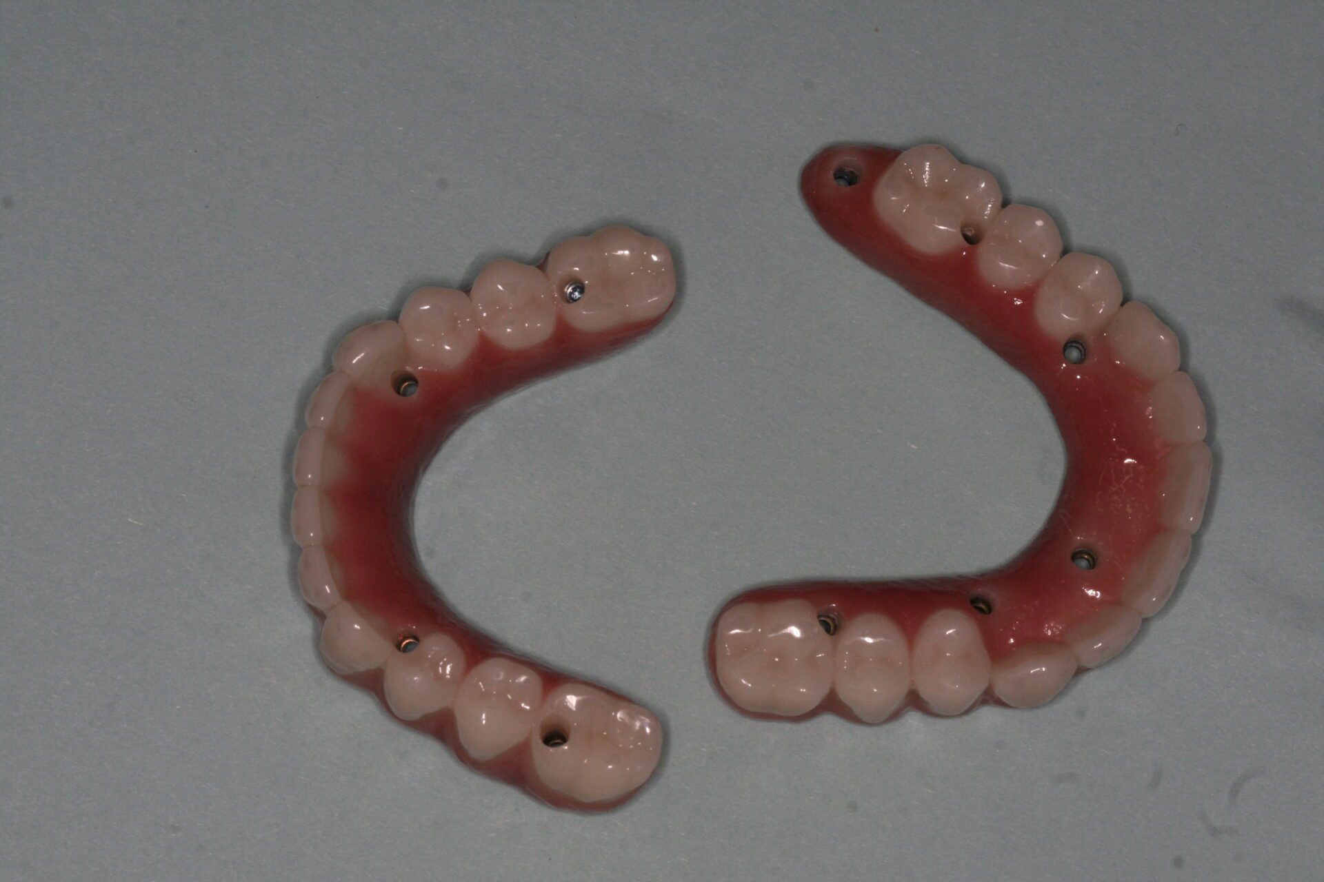 Oral Rehabilitation Case 3